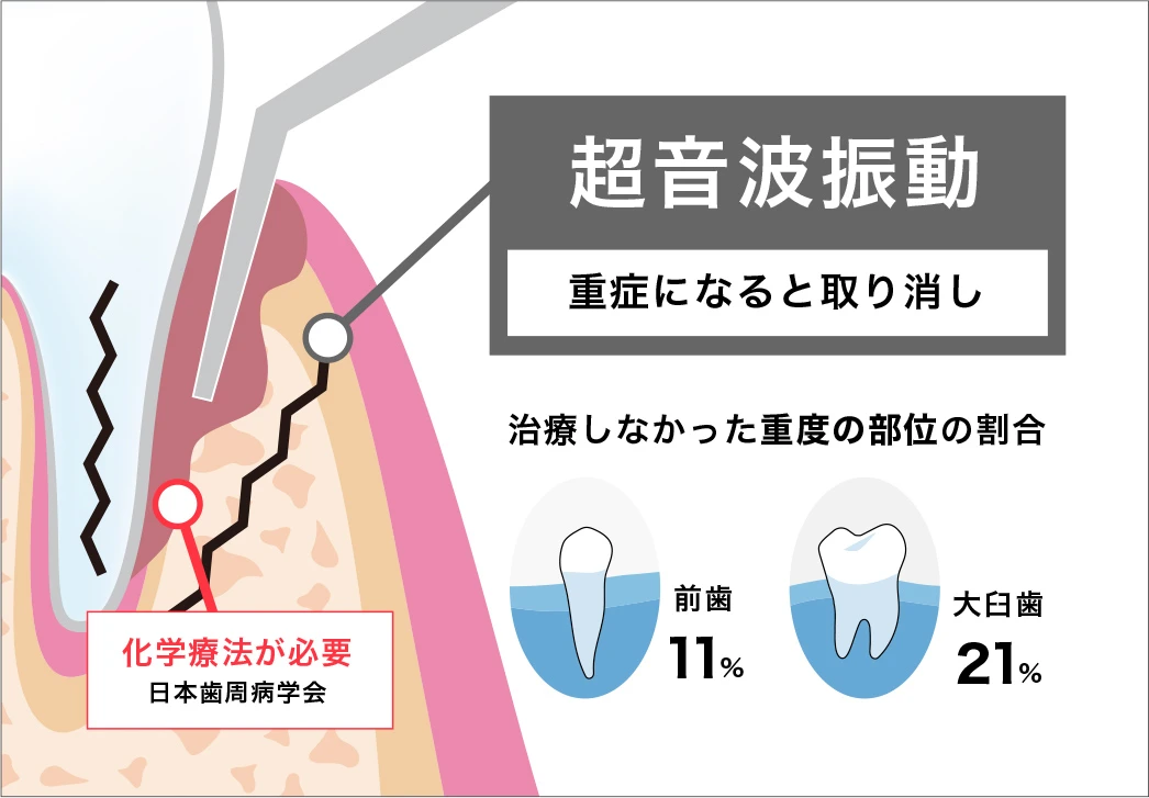 従来の治療方法の紹介